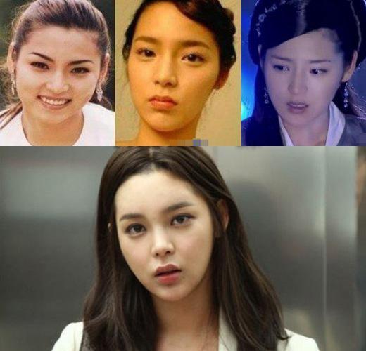 曾经的韩剧女主，整容失败后大变脸，这10位女星，让人滤镜破碎
